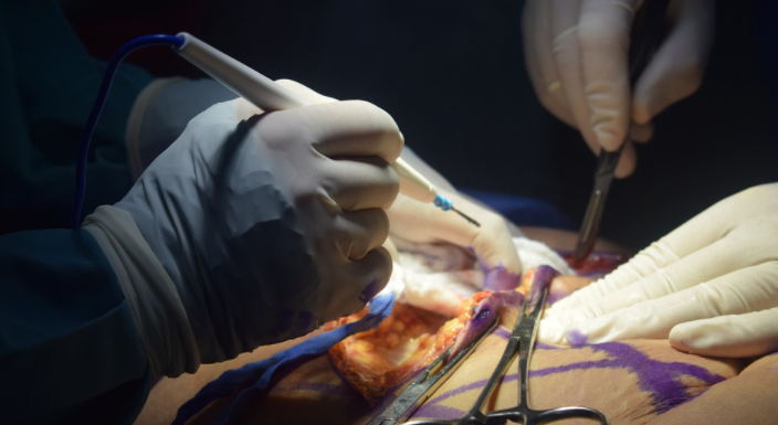 Tips to find the best Cosmetic Surgery Clinic